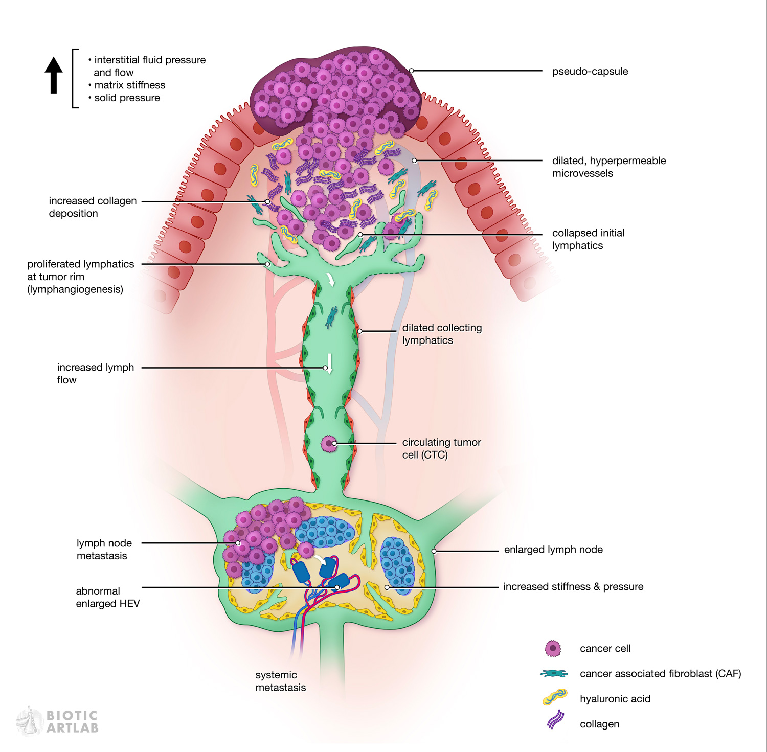 Cancerous lymphatic system biomechanics medical illustration
