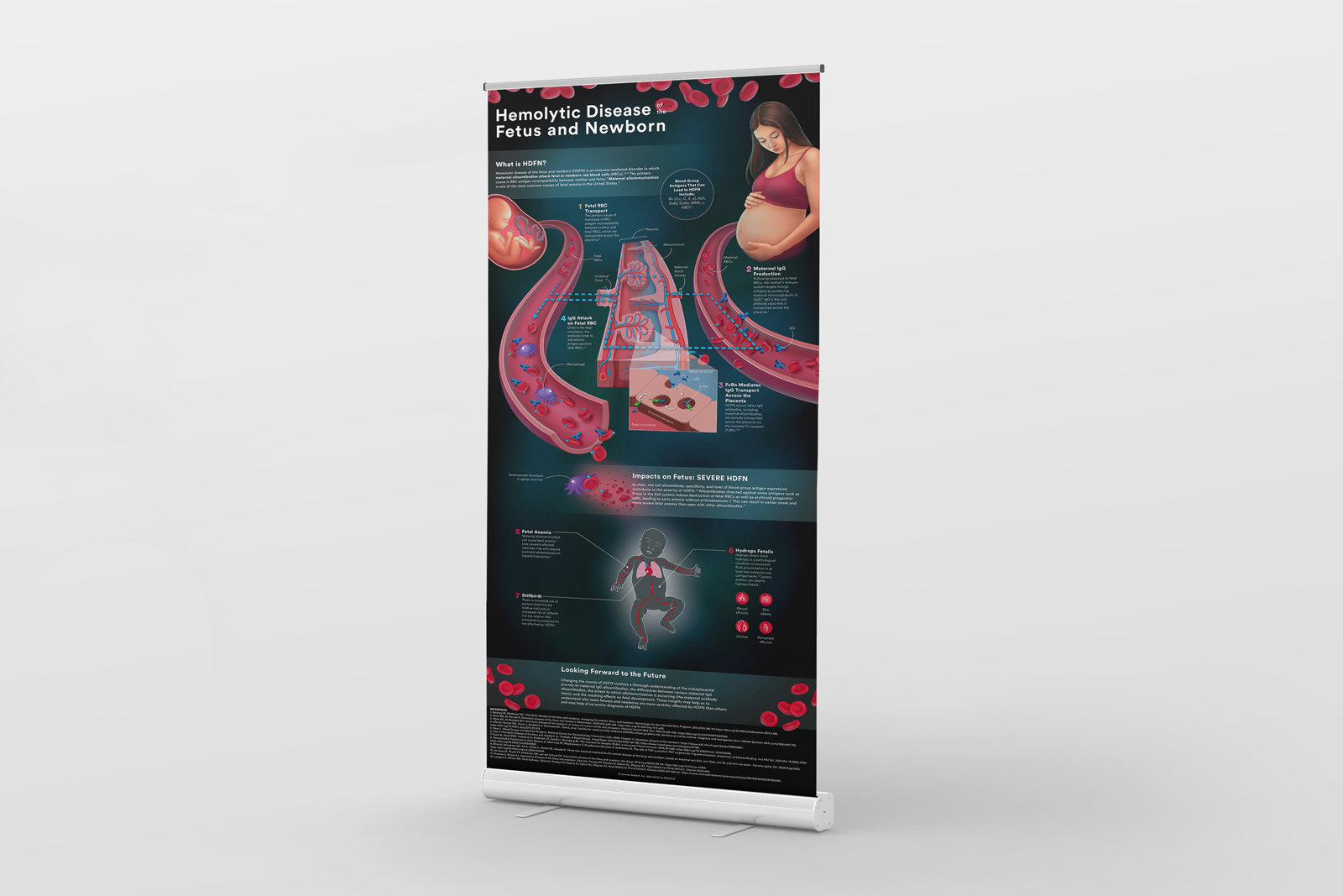 Hemolytic disease of the fetus and newborn (HDFN) conference banner mockup by Biotic Artlab