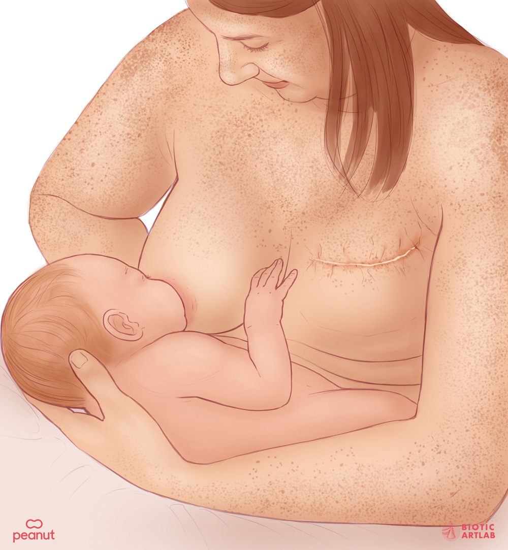 Breastfeeding medical illustration showing diverse skin tones for Peanut women's health app